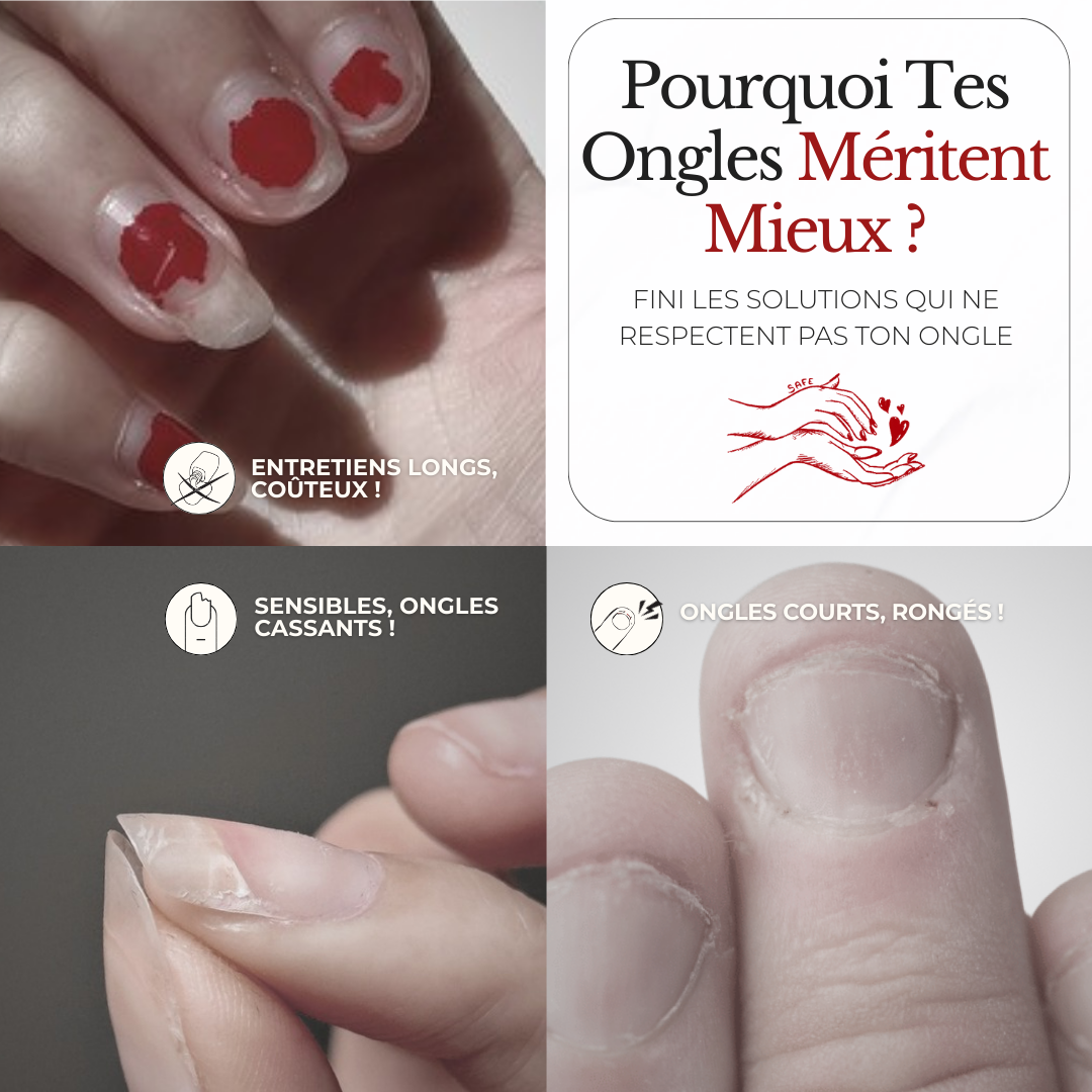 Solution Douce — des ongles pro, sans dégâts