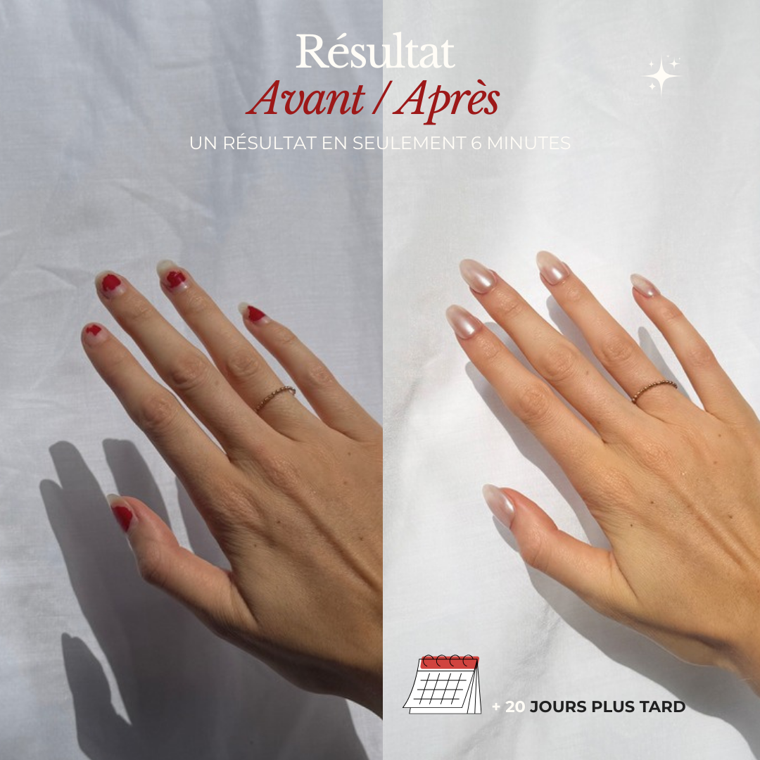 Solution Douce — des ongles pro, sans dégâts