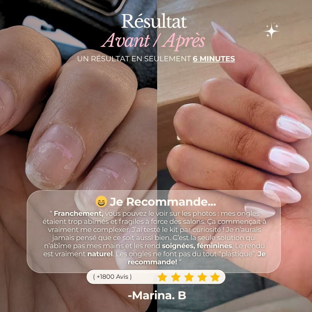 Solution Douce — des ongles pro, sans dégâts
